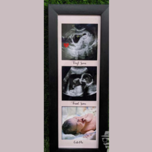 Baby Scan Frame