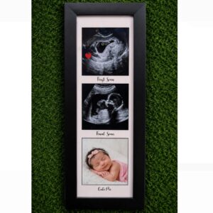 Baby Scan Frame